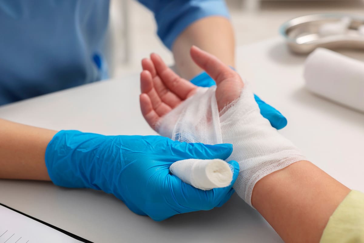 Doctor bandaging patient's burned hand in a wound care clinic.